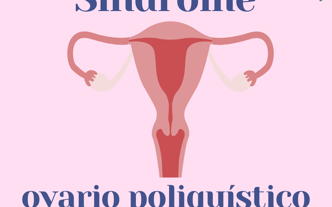 Síndrome del ovario poliquístico