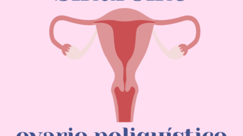 síndrome ovario poliquístico
