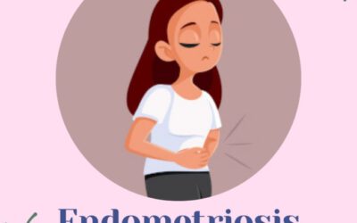 Endometriosis