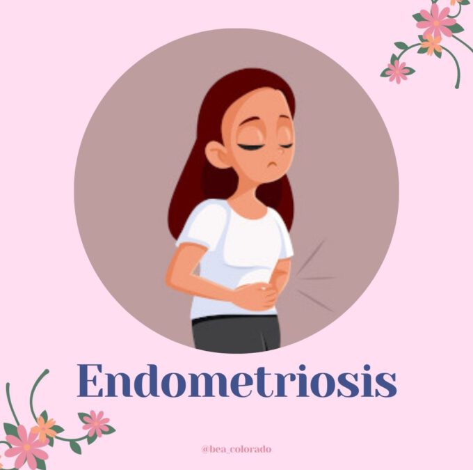 Endometriosis